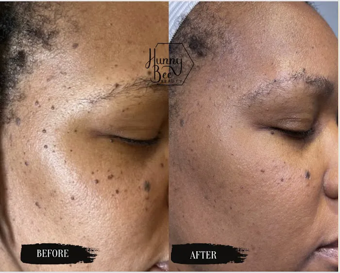 Hunny Bee Beauty Picture 3