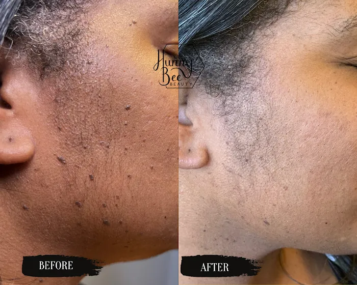 Hunny Bee Beauty Picture 6