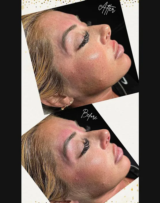 GLowinSkinWithCheLc Picture 4