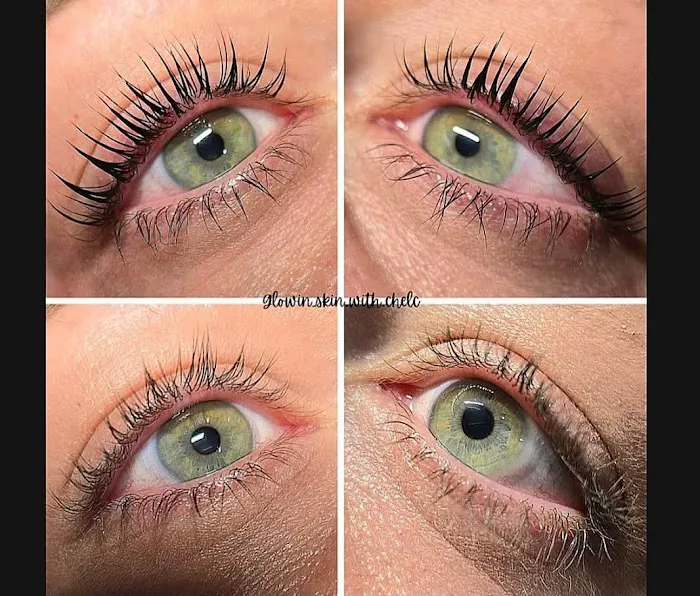 GLowinSkinWithCheLc Picture 5