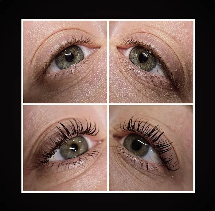 GLowinSkinWithCheLc Picture 8