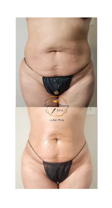 Imperium Beauty llc Picture 2