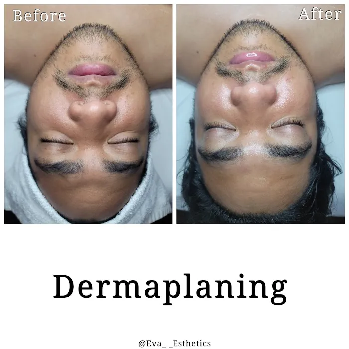 Eva Esthetics Picture 9