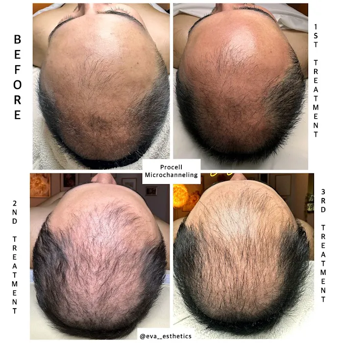 Eva Esthetics Picture 2