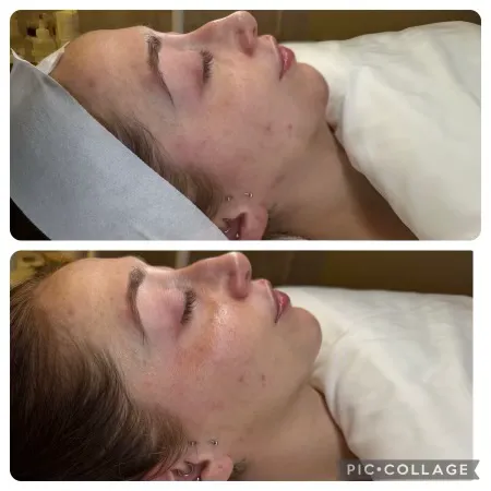 Glazed Skin Bar Picture 3