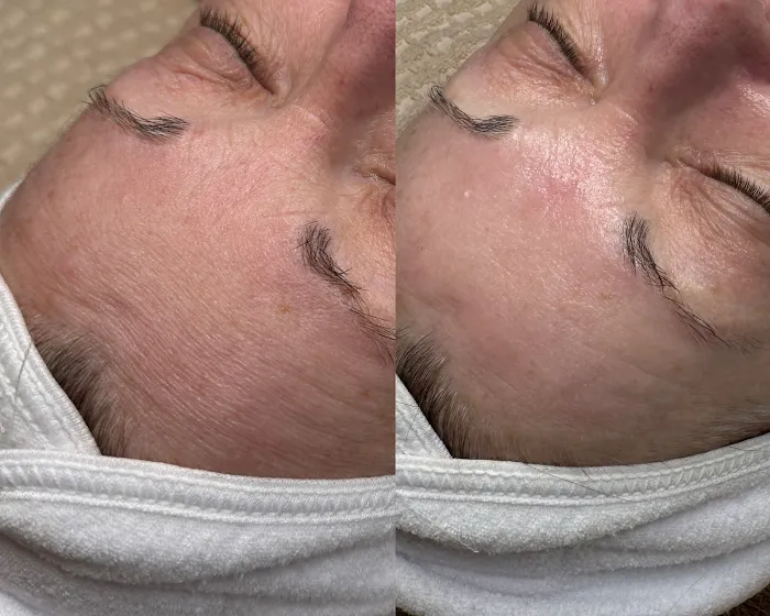 Glazed Skin Bar Picture 8