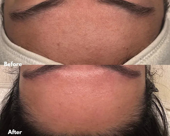 Glazed Skin Bar Picture 9