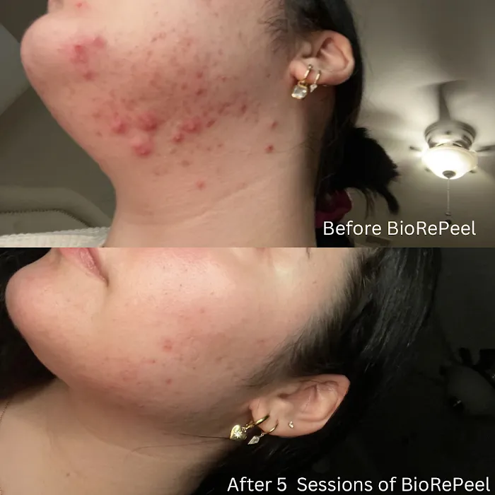 Glazed Skin Bar Picture 10