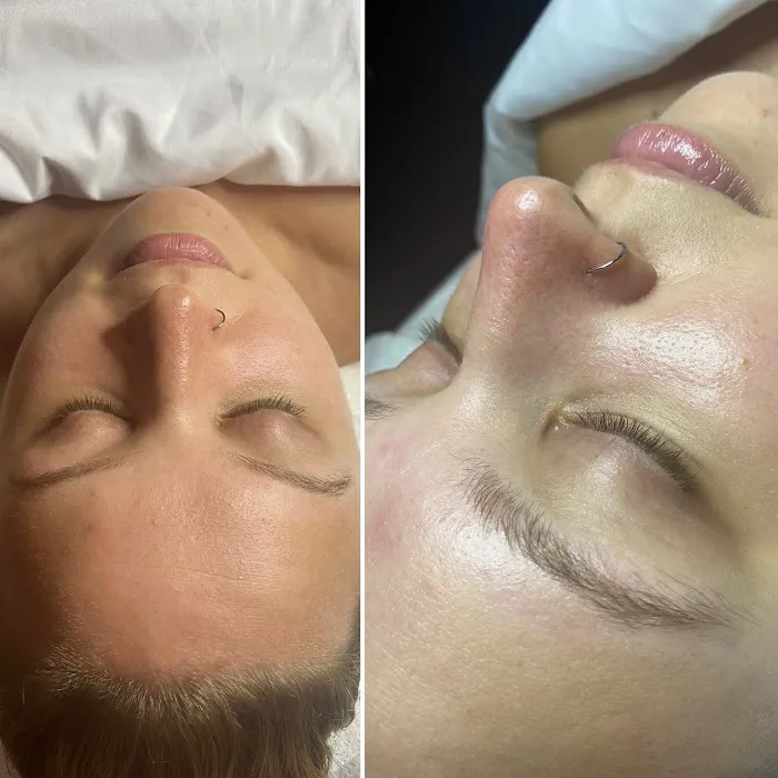 Pure Skin By Lara Picture 8