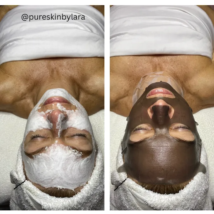 Pure Skin By Lara Picture 10