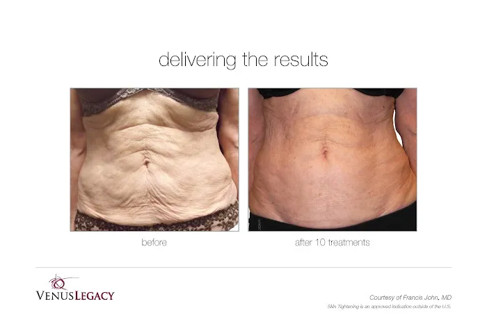 My Body Gorgeous Picture 4