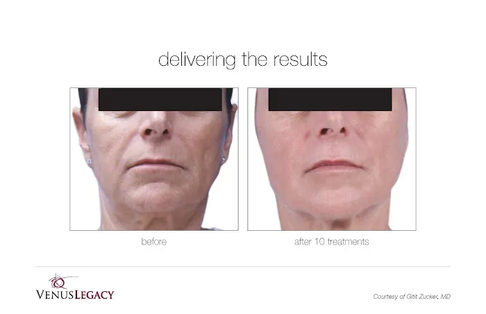 My Body Gorgeous Picture 2