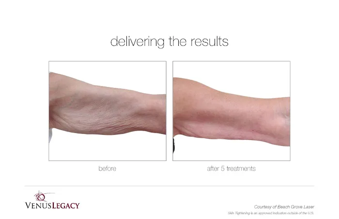 My Body Gorgeous Picture 5