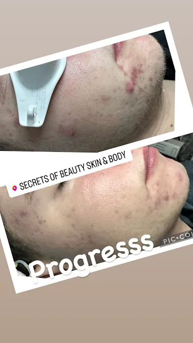 Secrets Of Beauty Skin & Body Picture 4