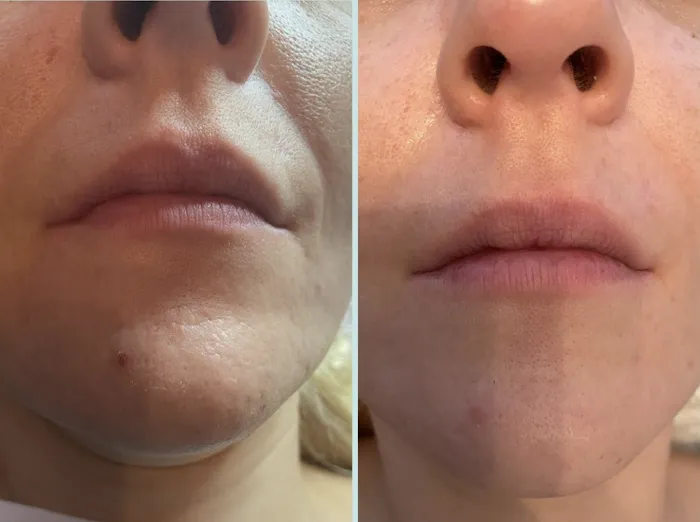 Let's Glow Skincare Picture 1