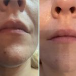 Let's Glow Skincare