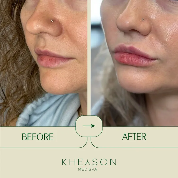 Kheyson Med Spa Picture 2