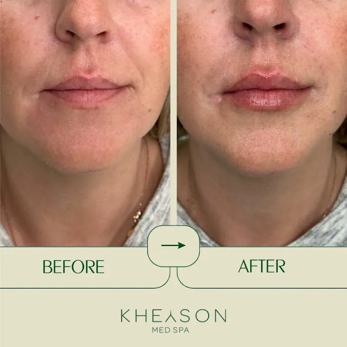 Kheyson Med Spa Picture 1