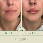 Kheyson Med Spa