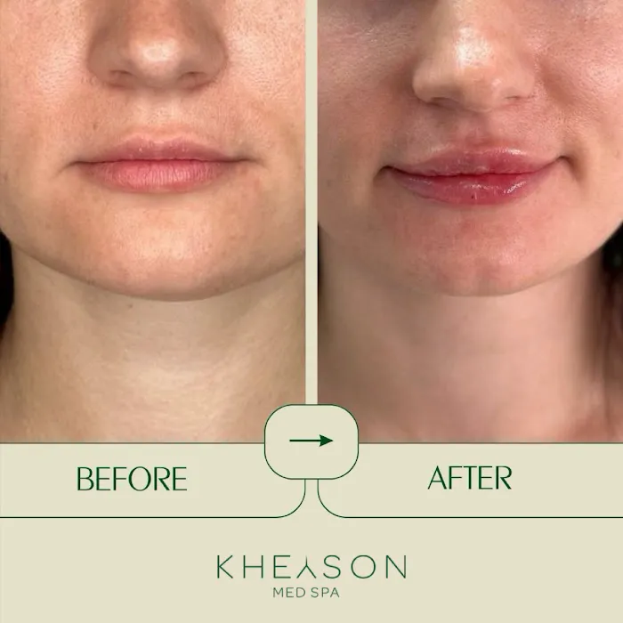 Kheyson Med Spa Picture 8