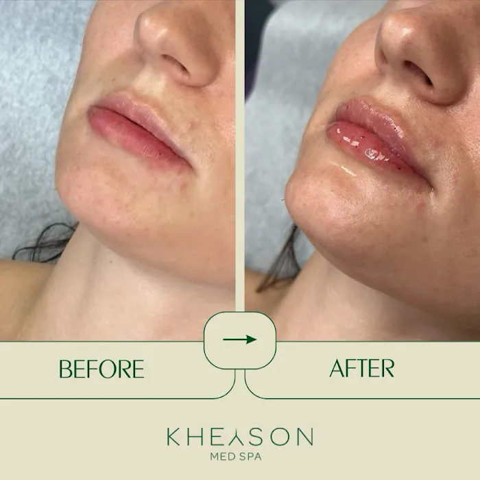 Kheyson Med Spa Picture 9