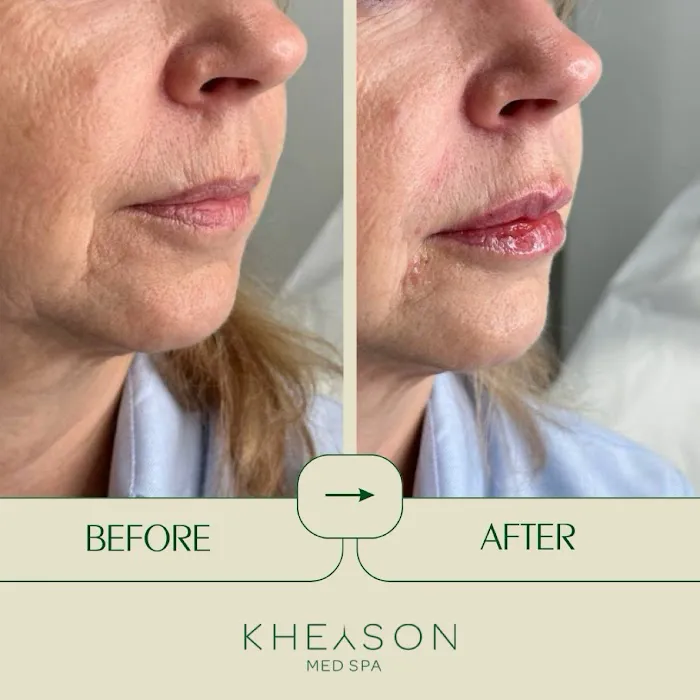 Kheyson Med Spa Picture 5