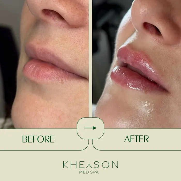 Kheyson Med Spa Picture 6