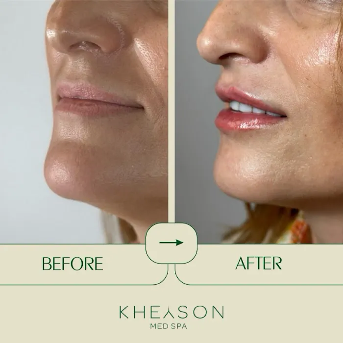 Kheyson Med Spa Picture 4