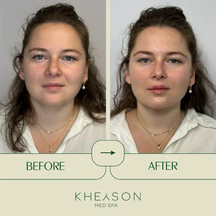 Kheyson Med Spa Picture 10