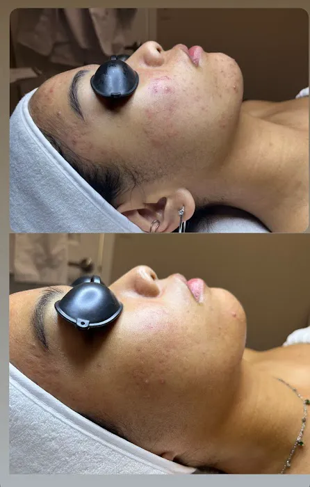 Ash Glow Aesthetics Picture 7