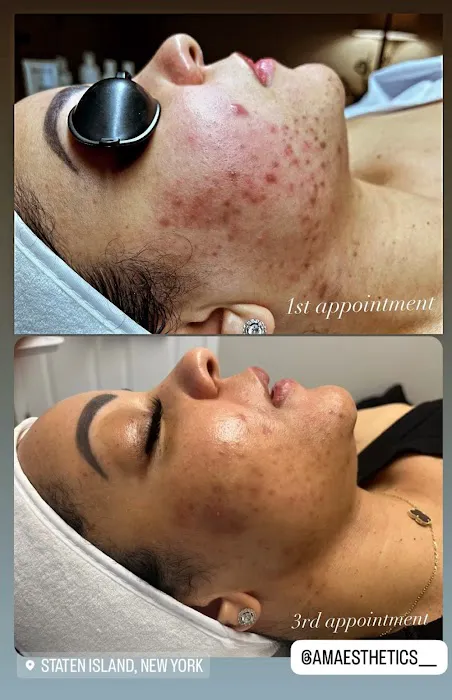 Ash Glow Aesthetics Picture 6