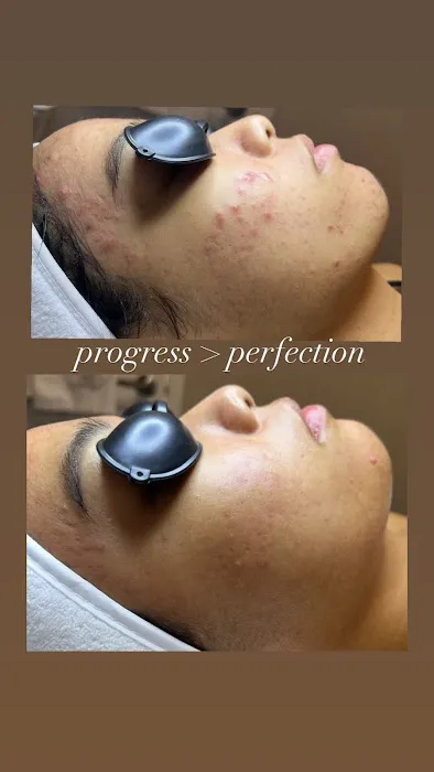 Ash Glow Aesthetics Picture 4