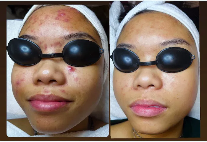 Ash Glow Aesthetics Picture 10