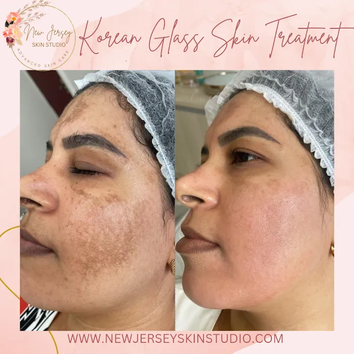 New Jersey Skin Studio Picture 10