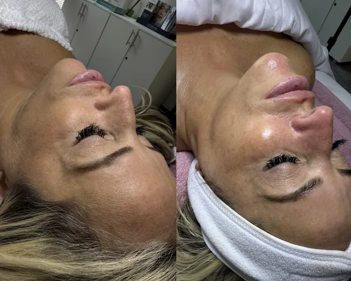 Outlast Aesthetics – Valerie Moniz, Lead Aesthetician | Tinton Falls, NJ Picture 3