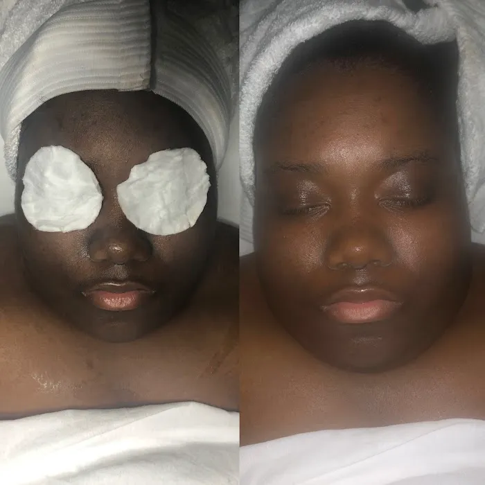 BBeautiful Skin Picture 6