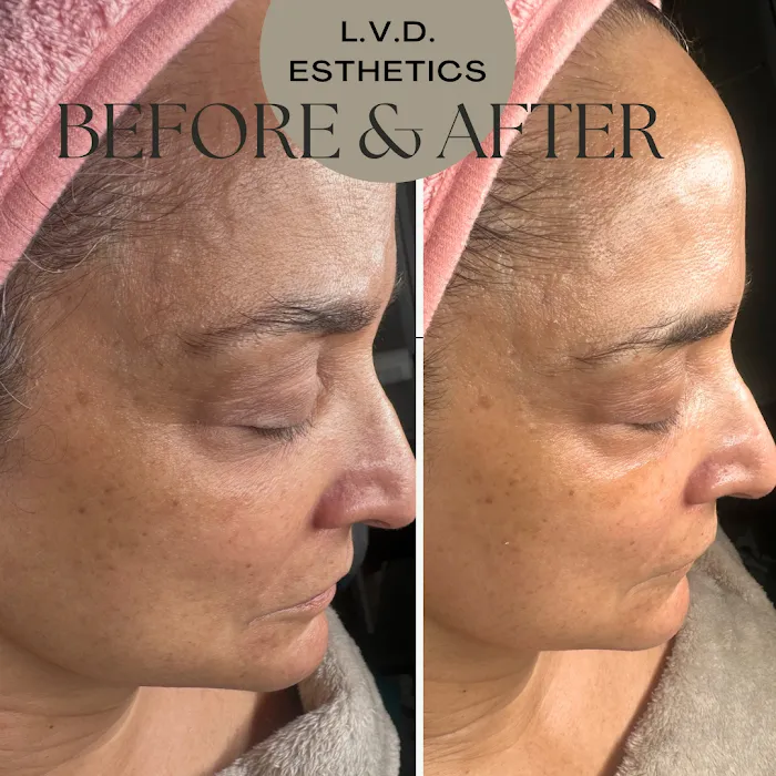 La Ver-Da Esthetics Picture 5