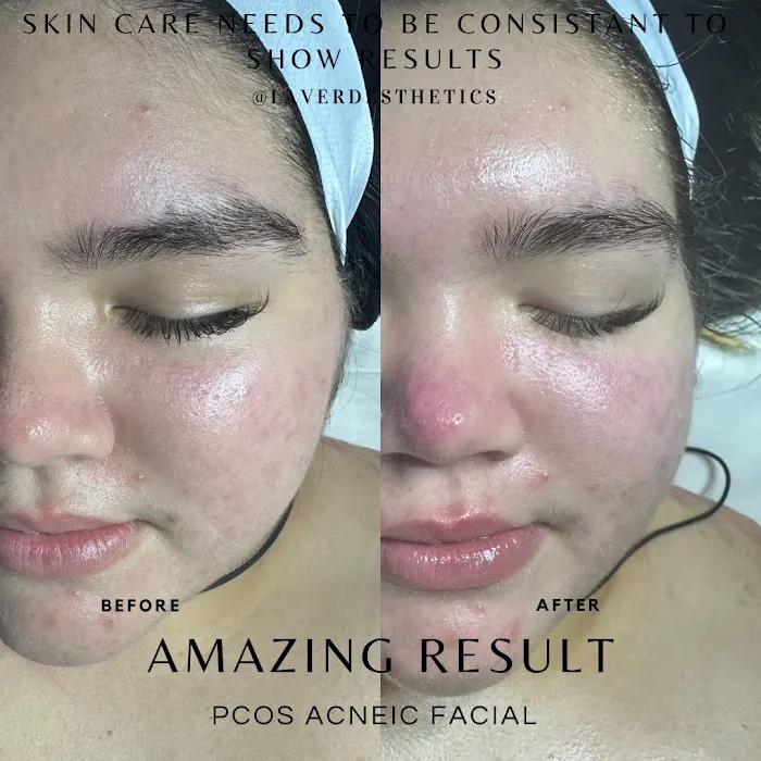 La Ver-Da Esthetics Picture 6