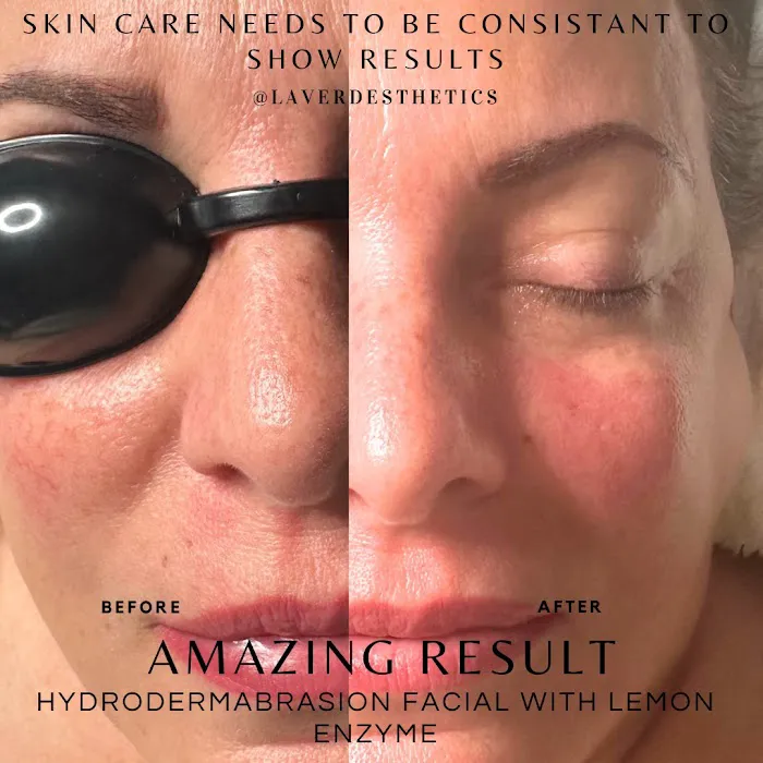 La Ver-Da Esthetics Picture 8