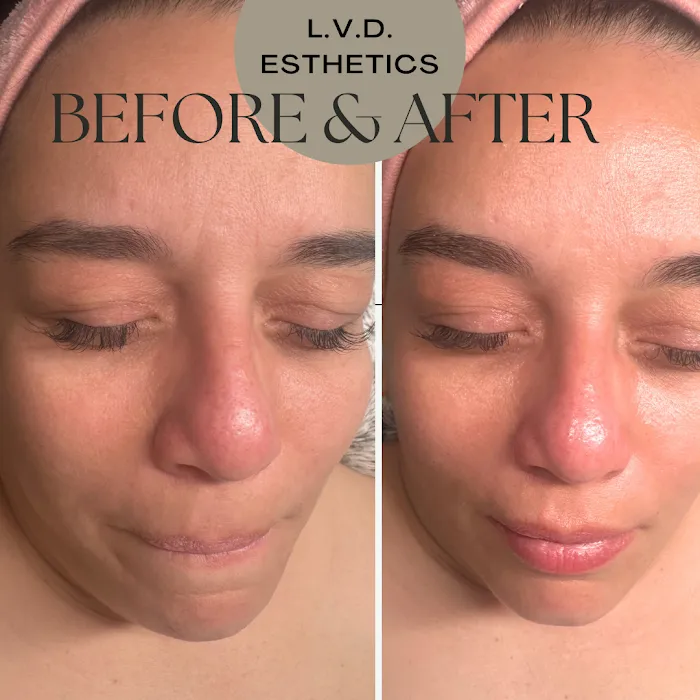 La Ver-Da Esthetics Picture 10