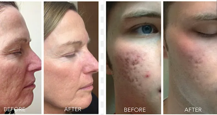 Medical Skin Rejuvenation and Wellness Center PLLC Picture 3