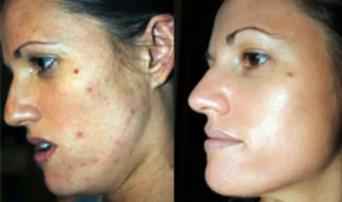 Medical Skin Rejuvenation and Wellness Center PLLC Picture 2