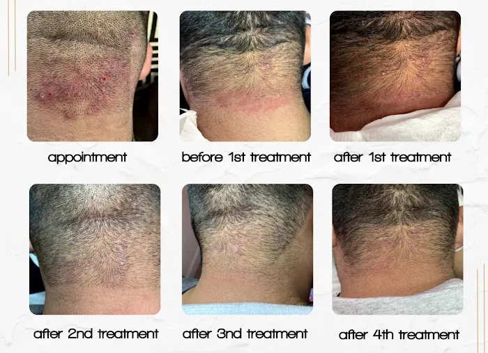 Blended Skin Picture 5