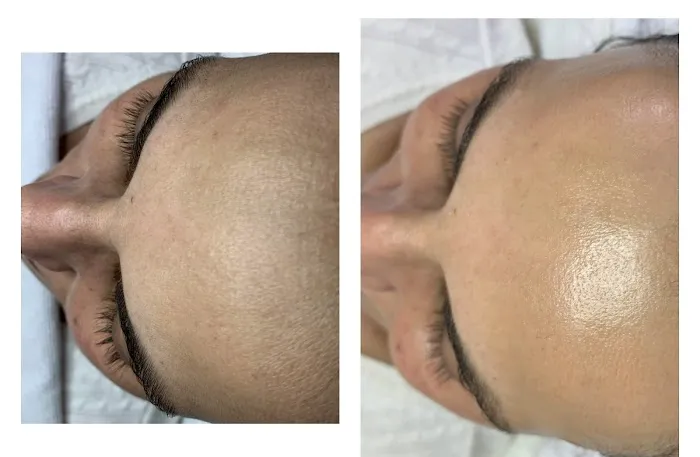 Blended Skin Picture 4