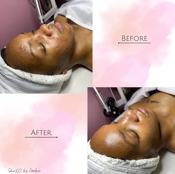 SkinXO by Candice Picture 6