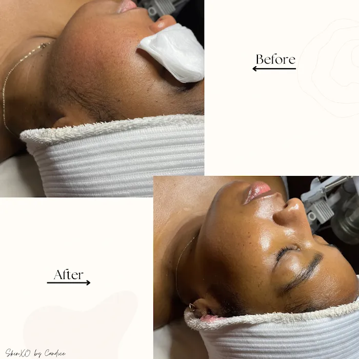 SkinXO by Candice Picture 9