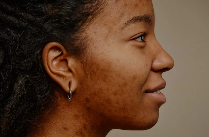 Beneath the Skin ~ Corrective Skincare Solutions Picture 8