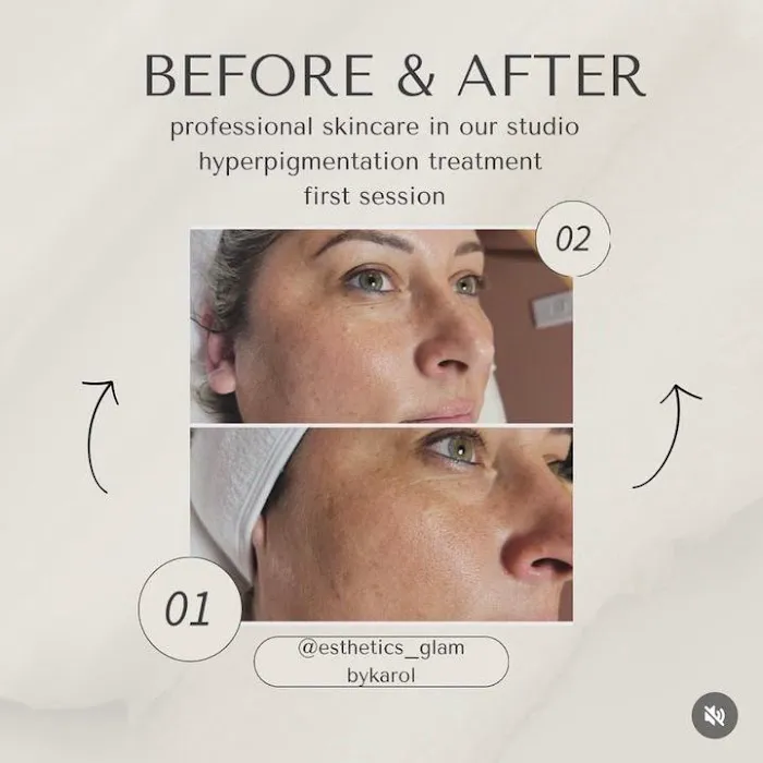 Joha's Esthetic Glam Picture 7