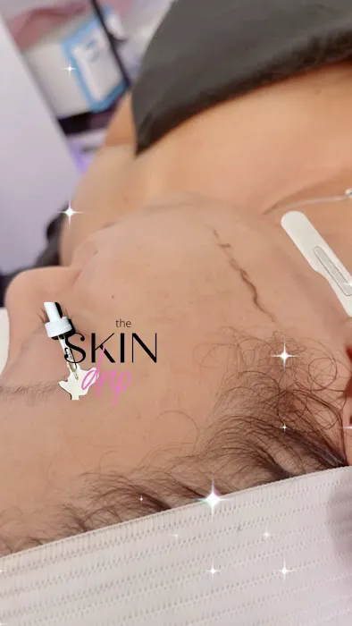 The Skin Drip Picture 8