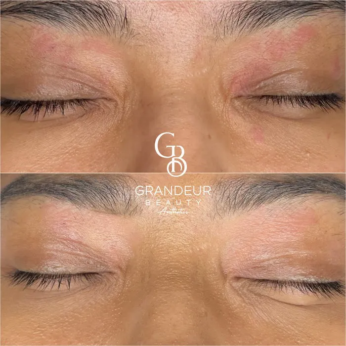 Grandeur Beauty Aesthetics Picture 2